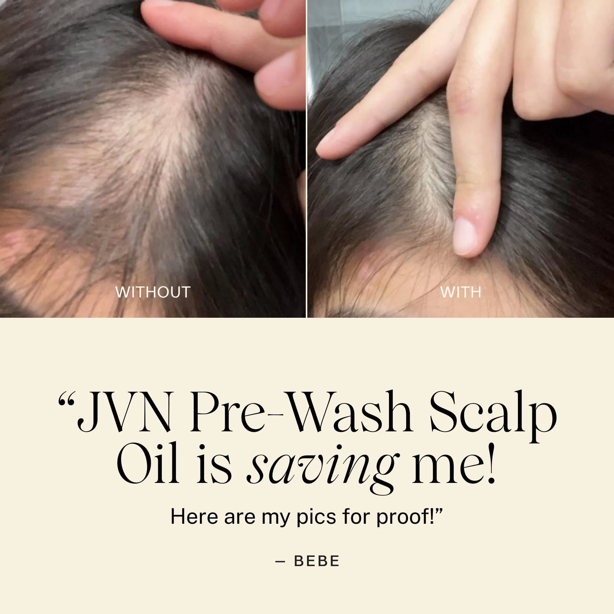 Complete Pre-Wash Scalp Oil - Image 10